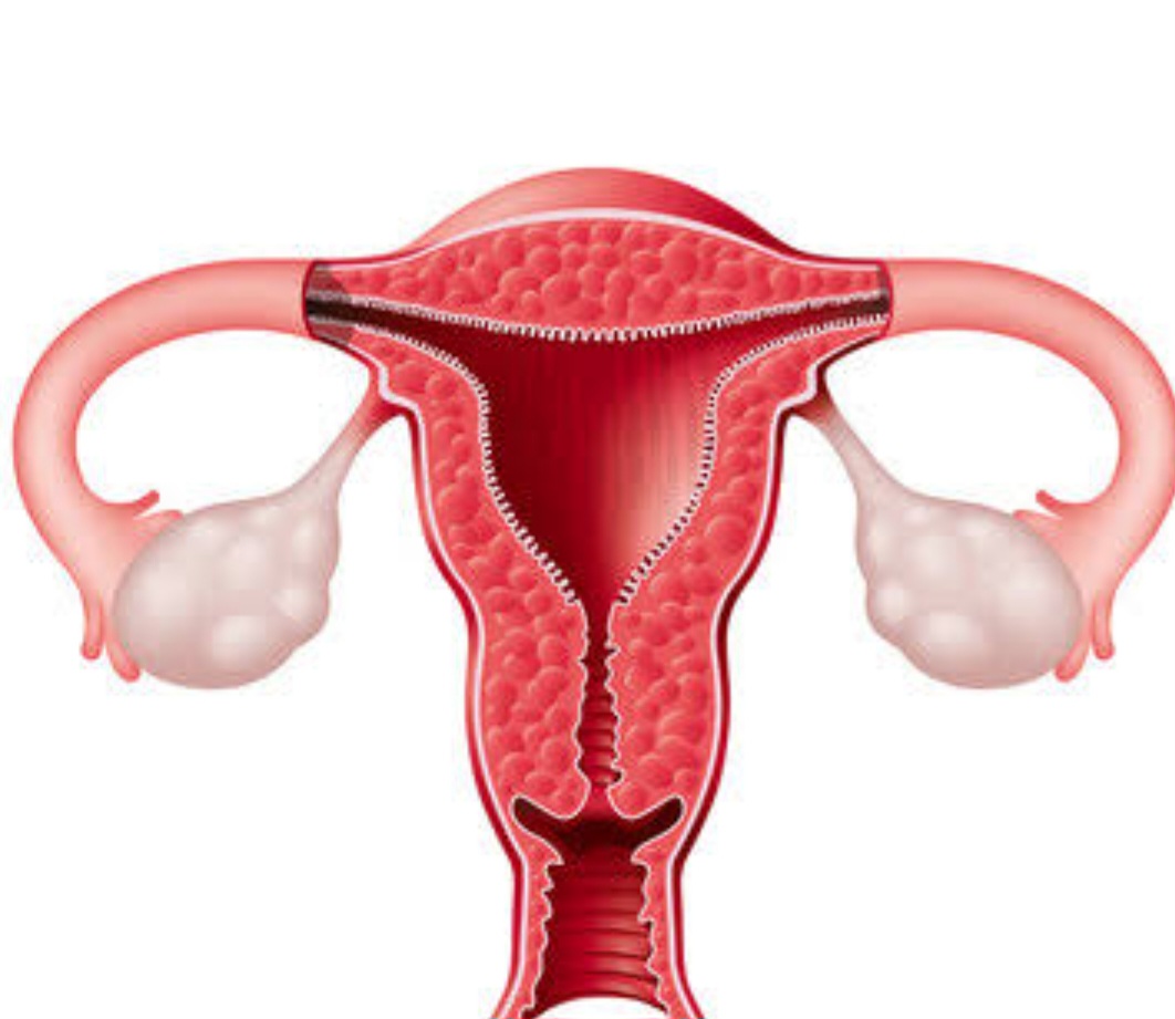 Gynecology     uterus pcod/pcos